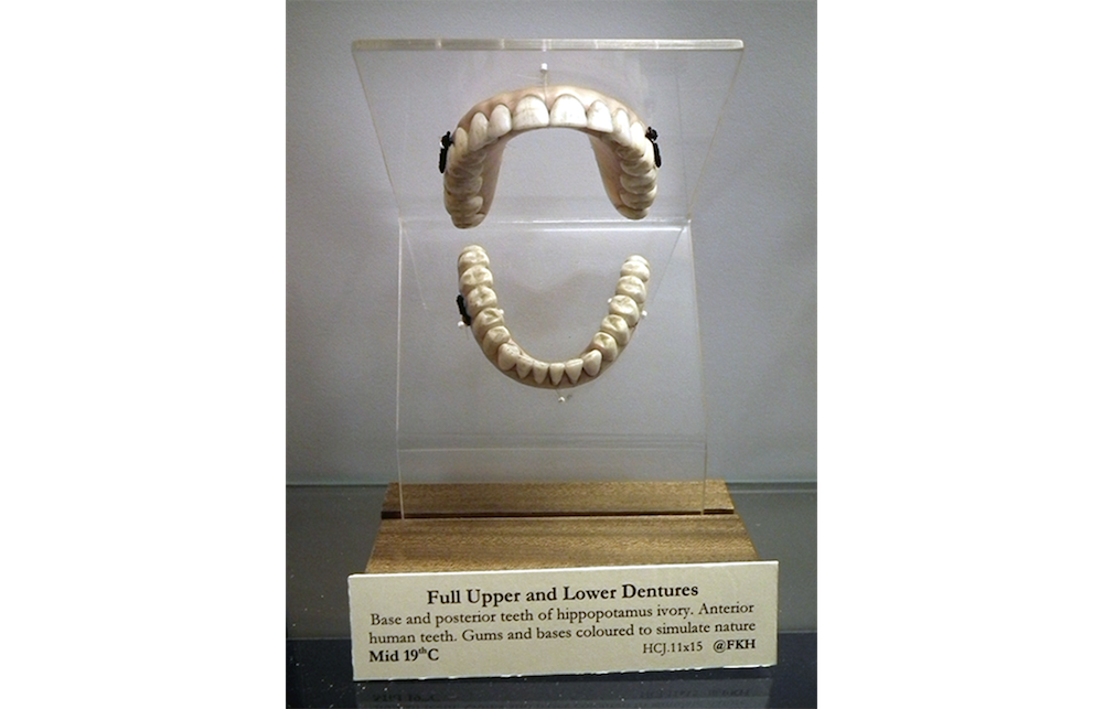 Dentures made from hippopotamus ivory.